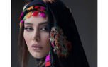 عکس حیرت آور سحر قریشی قبل از بازیگری ! / چی بود و با عمل زیبایی چی شد ؟!